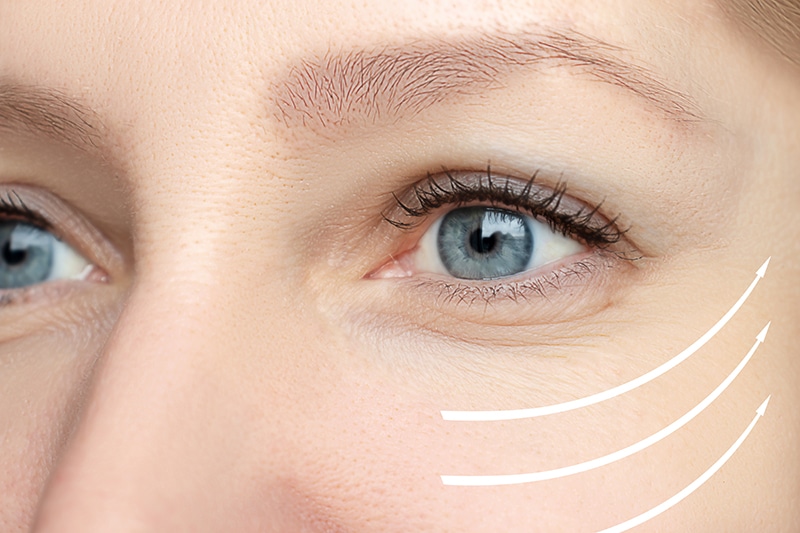 Dyston gel and botox